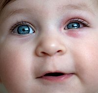 Causes, Types, and Treatment of Pink Eye