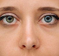 Heterochromia: A Fascinating Eye Color Mutation