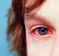 How Our Eyes Respond To Irritants